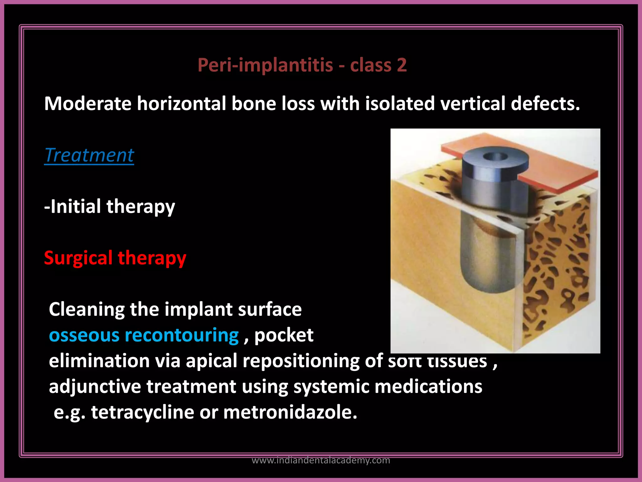 Peri-implantitis - class 2
Moderate horizontal bone loss with isolated vertical defects.
Treatment
-Initial therapy
Surgical therapy
Cleaning the implant surface
osseous recontouring , pocket
elimination via apical repositioning of soft tissues ,
adjunctive treatment using systemic medications
e.g. tetracycline or metronidazole.
www.indiandentalacademy.com
 