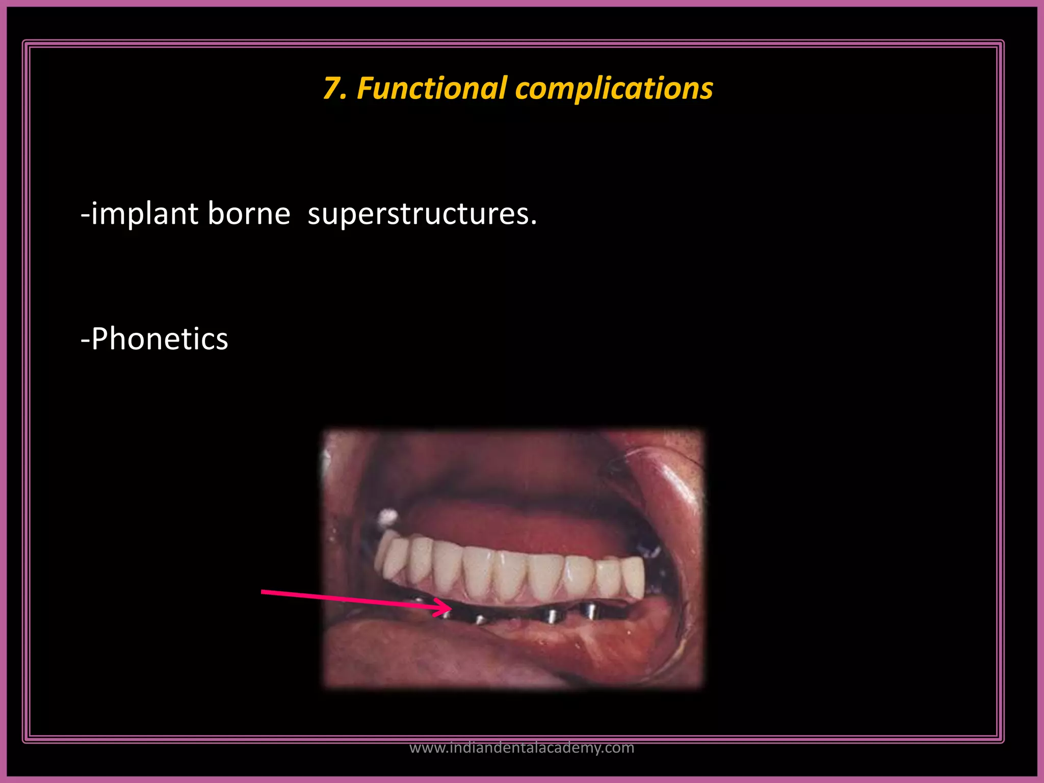 7. Functional complications
-implant borne superstructures.
-Phonetics
www.indiandentalacademy.com
 