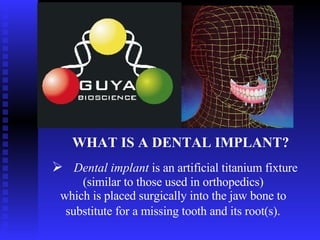 WHAT IS A   DENTAL IMPLANT?   ,[object Object],[object Object],[object Object]