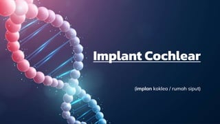 Implant Cochlear
(implan koklea / rumah siput)
 