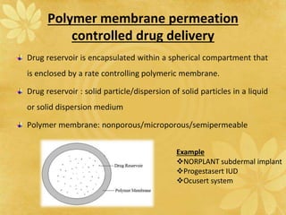 Polymer membrane permeation
controlled drug delivery
Drug reservoir is encapsulated within a spherical compartment that
is enclosed by a rate controlling polymeric membrane.
Drug reservoir : solid particle/dispersion of solid particles in a liquid
or solid dispersion medium
Polymer membrane: nonporous/microporous/semipermeable
Example
NORPLANT subdermal implant
Progestasert IUD
Ocusert system
 