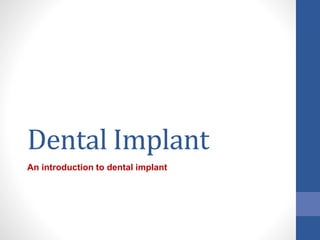 Dental Implant
An introduction to dental implant
 