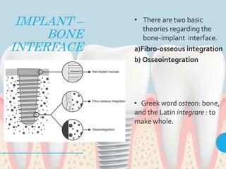 Implant | PPTX