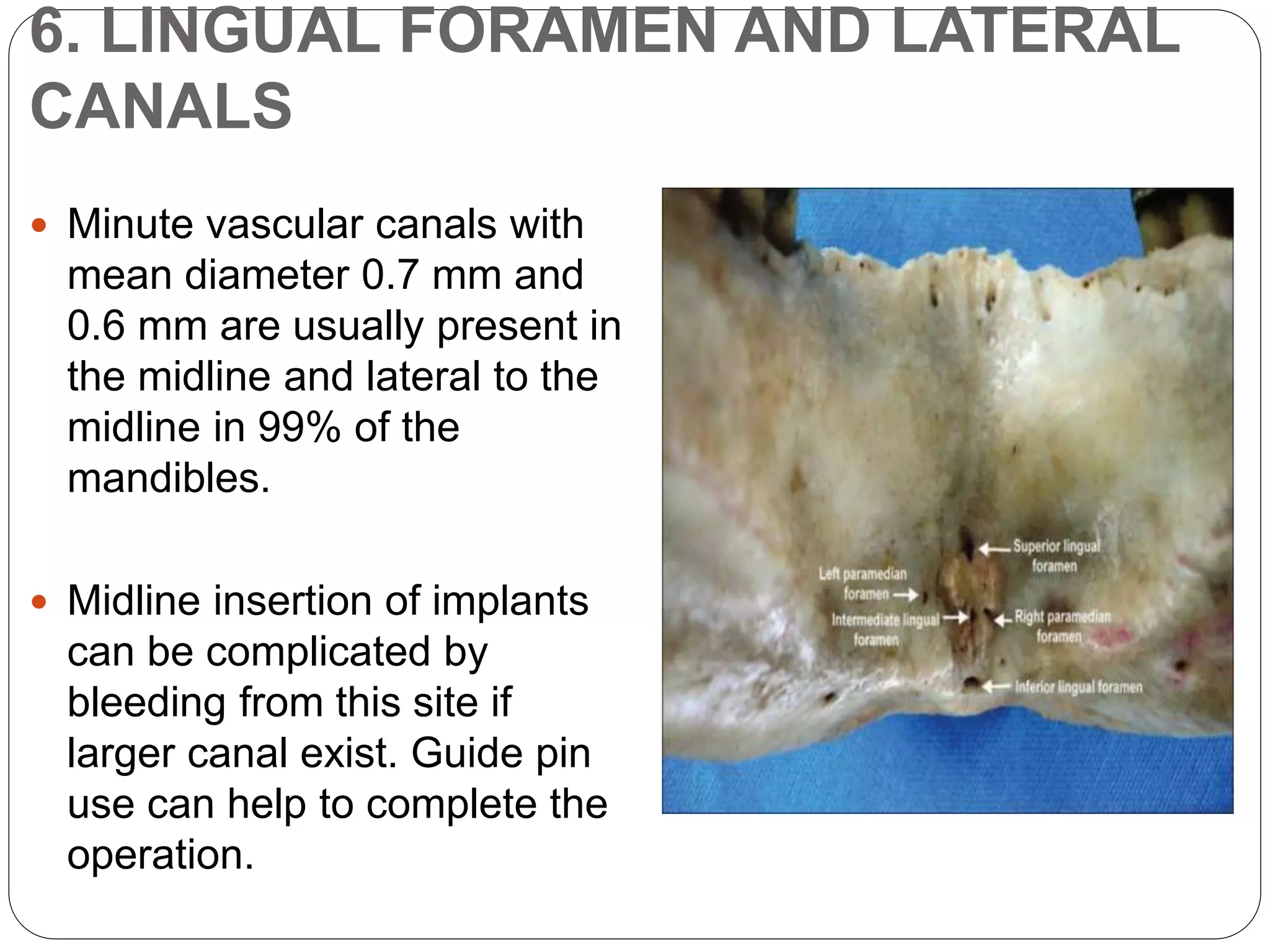 Applied Anatomy For Denta Implant PPTX applied-anatomy-for-denta-implant-pptx