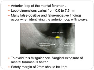 applied anatomy for denta Implant | PPTX