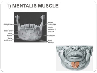 Intercheilion Line applied anatomy for denta Implant | PPTX