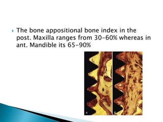  The bone appositional bone index in the
post. Maxilla ranges from 30-60% whereas in
ant. Mandible its 65-90%
 