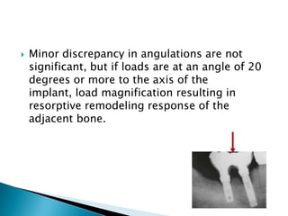  Minor discrepancy in angulations are not
significant, but if loads are at an angle of 20
degrees or more to the axis of the
implant, load magnification resulting in
resorptive remodeling response of the
adjacent bone.
 