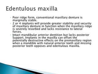 ◦ Poor ridge form, conventional maxillary denture is
marginally stable.
◦ 2 or 4 implants will provide greater stability and security
of maxillary denture in function when the maxillary ridge
is severely resorbed and lacks resistance to lateral
forces.
◦ Intact mandibular anterior dentition but lacks posterior
Support. Implants in the maxilla can offset the
potentially destructive effects on the premaxillary region
when a mandible with natural anterior teeth and missing
posterior teeth opposes and edentulous maxilla.
 