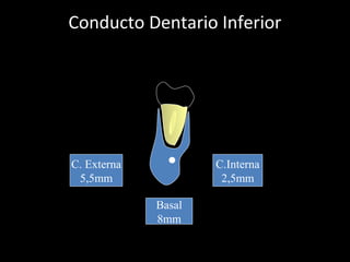 Conducto Dentario Inferior
C.Interna
2,5mm
C. Externa
5,5mm
Basal
8mm
 
