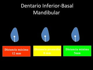 Dentario Inferior-Basal
Mandibular
Distancia máxima
12 mm
Distancia promedio
8 mm
Distancia mínima
5mm
 