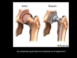Se comportan igual todos los implantes en el organismo?
 
