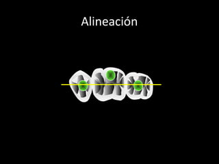 Alineación
 