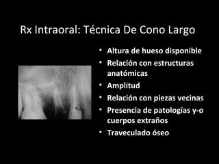 Rx Intraoral: Técnica De Cono Largo
• Altura de hueso disponible
• Relación con estructuras
anatómicas
• Amplitud
• Relación con piezas vecinas
• Presencia de patologías y-o
cuerpos extraños
• Traveculado óseo
 