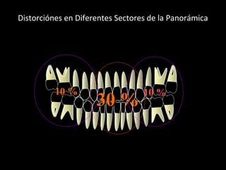 Distorciónes en Diferentes Sectores de la Panorámica
En Sentido Vertical
30 %30 %
Sector
Anterior
10 %10 %
Sector
Posterior
10 %10 %
Sector
Posterior
 