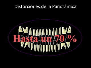 Distorciónes de la Panorámica
En Sentido Horizontal
Hasta un 70 %Hasta un 70 %
 