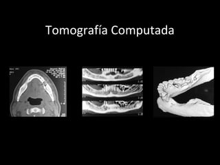 Tomografía Computada
 