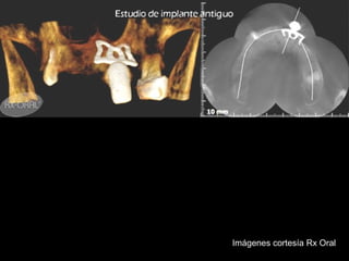 Imágenes cortesía Rx Oral
 