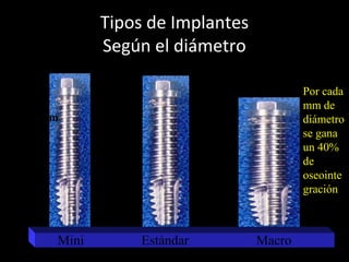 3.75
a
4 mm
< 3.75 mm
> 4 mm
Tipos de Implantes
Según el diámetro
Mini Estándar Macro
Por cada
mm de
diámetro
se gana
un 40%
de
oseointe
gración
 