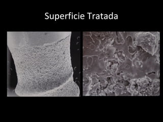 Superficie Tratada
 
