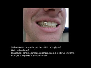 Todo el mundo es candidato para recibir un implante?
Qué es el rechazo ?
Hay algunas condicionantes para ser candidato a recibir un implante?
Es mejor el implante al diente natural?
 