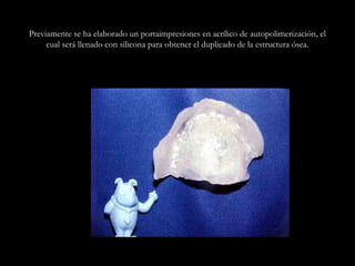 Previamente se ha elaborado un portaimpresiones en acrílico de autopolimerización, el
cual será llenado con silicona para obtener el duplicado de la estructura ósea.
 