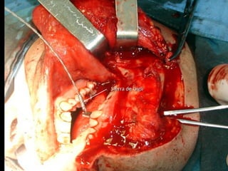 Sierra de GigliSierra de Gigli
 