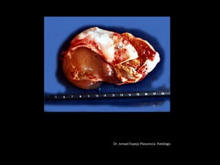 Dr. Ismael Espejo Plascencia PatólogoDr. Ismael Espejo Plascencia Patólogo
 