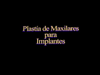 Plastia de maxilares para implantes dentales.
 