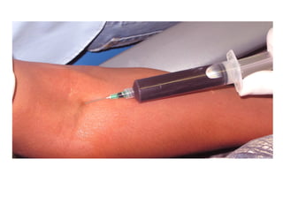 Toma de sangre para obtención de factores de crecimiento en plasma
rico en plaquetas.
 