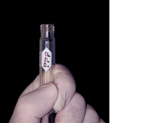 Etiquetado cuidadoso
de los diferentes tipos
de sangre a obtener, en
este caso Plasma
Pobre en Plaquetas.
 