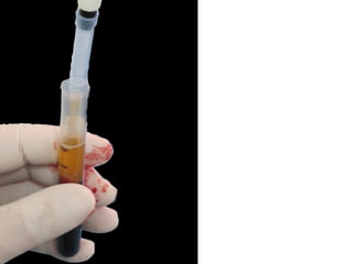 Pipeteo cuidadoso de Fracción I
 