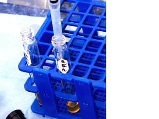 Gradilla con tubos
debidamente
etiquetados, cuando
son más de dos
pacientes, alerta!
Habrá que poner el
nombre de cada uno.
 