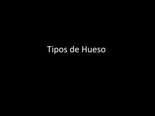 Tipos de Hueso
 