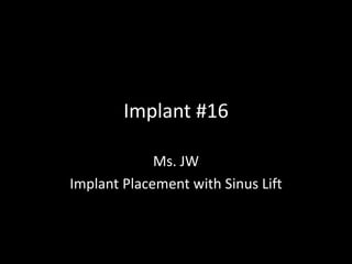 Implant #16

             Ms. JW
Implant Placement with Sinus Lift
 