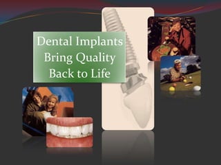 Dental Implants
 Bring Quality
  Back to Life
 