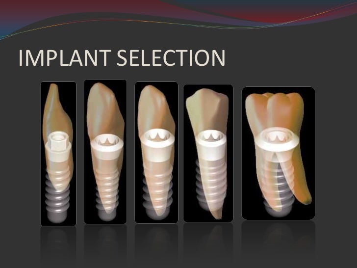 Contemporary Implant Dentistry, 3e, 2007 Contemporary Implant Dentistry, 3e, 2007