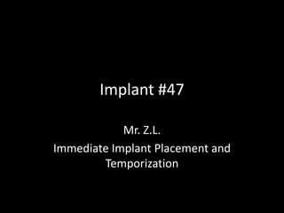 Implant #47

            Mr. Z.L.
Immediate Implant Placement and
        Temporization
 