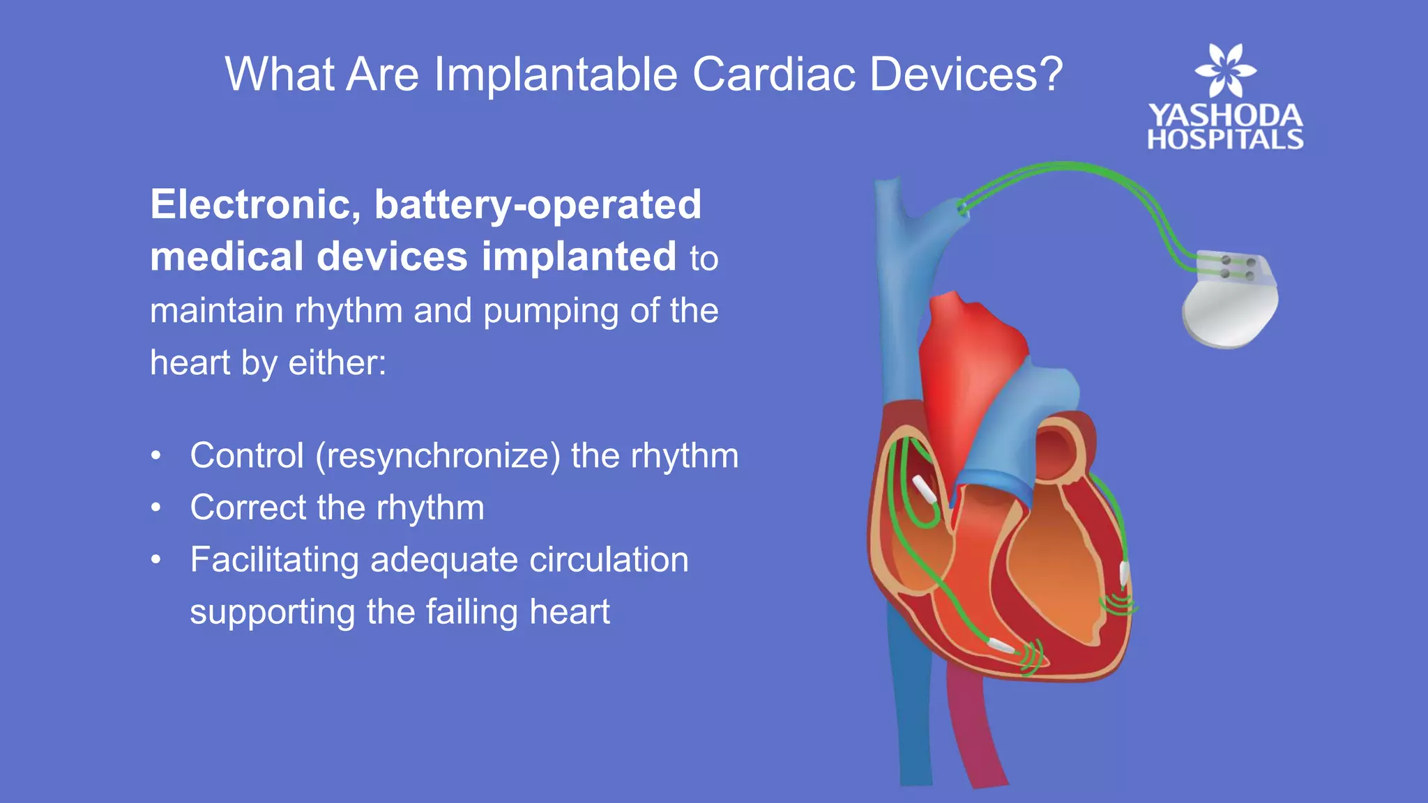 Pacemaker | Implantable Cardiac Devices For Heart Failures | PPT
