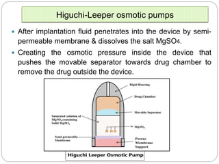 Implantable dds ppt mali vv