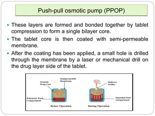 Implantable dds ppt mali vv