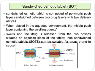 Implantable dds ppt mali vv
