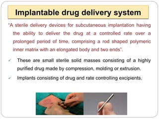 Implantable dds ppt mali vv