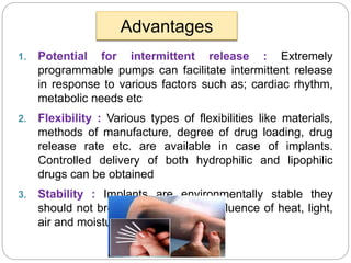 Implantable dds ppt mali vv