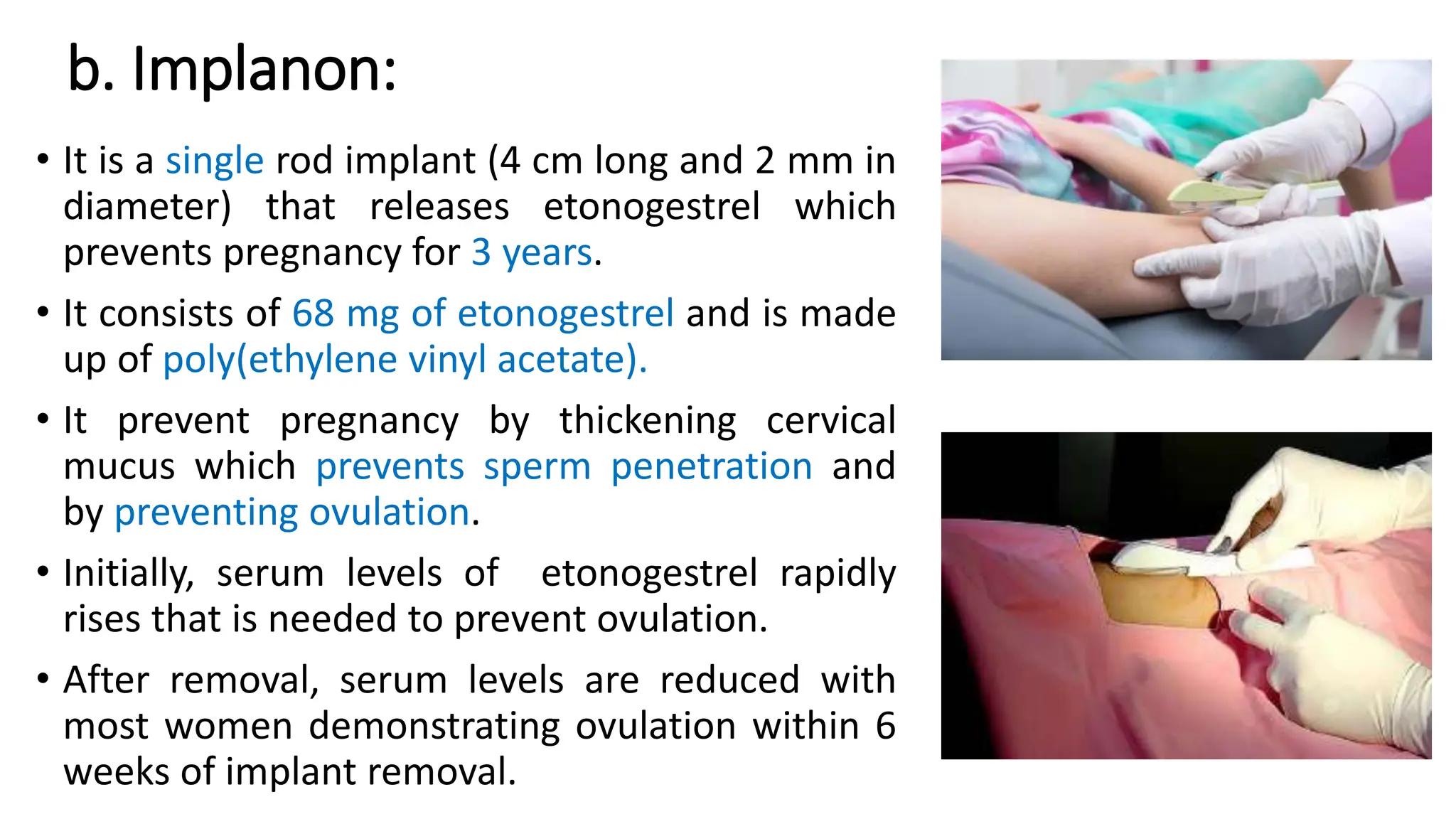 b. Implanon:
• It is a single rod implant (4 cm long and 2 mm in
diameter) that releases etonogestrel which
prevents pregnancy for 3 years.
• It consists of 68 mg of etonogestrel and is made
up of poly(ethylene vinyl acetate).
• It prevent pregnancy by thickening cervical
mucus which prevents sperm penetration and
by preventing ovulation.
• Initially, serum levels of etonogestrel rapidly
rises that is needed to prevent ovulation.
• After removal, serum levels are reduced with
most women demonstrating ovulation within 6
weeks of implant removal.
 