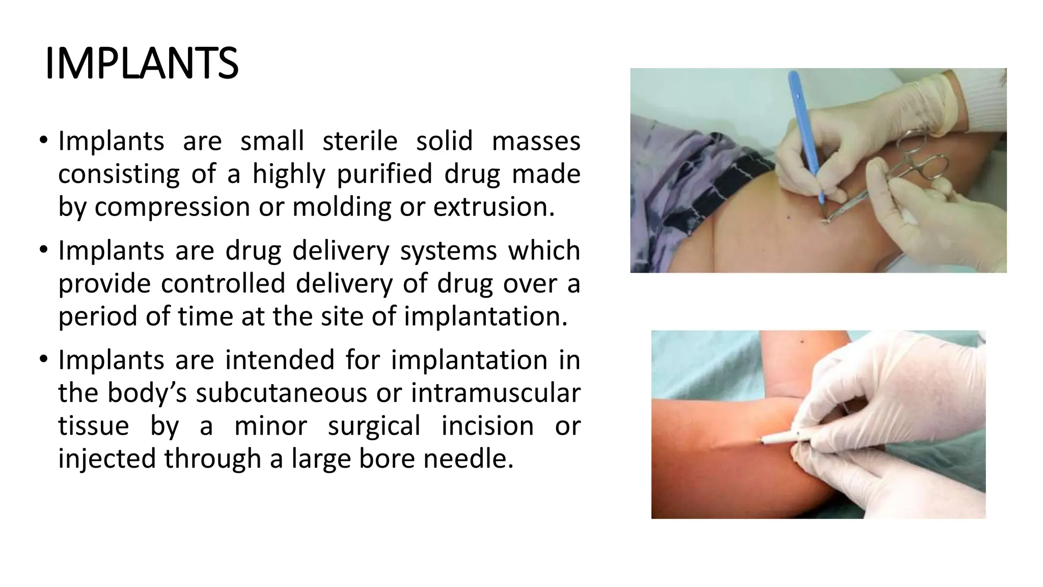 IMPLANTS
• Implants are small sterile solid masses
consisting of a highly purified drug made
by compression or molding or extrusion.
• Implants are drug delivery systems which
provide controlled delivery of drug over a
period of time at the site of implantation.
• Implants are intended for implantation in
the body’s subcutaneous or intramuscular
tissue by a minor surgical incision or
injected through a large bore needle.
 