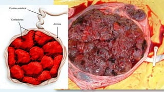 Placenta
• Morfológicamente la placenta tiene una cara materna y una cara fetal.
• Cara materna: esta en contacto con el útero tiene una superficie irregular debido
a la presencia de los cotiledones (15 a 20) cubiertas por una delgada capa de
decidua basal y separadas por surcos formados por los tabiques deciduales
 