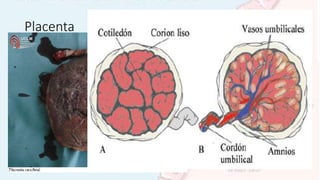 Placenta
• Cara fetal
• Su superficie es lisa y esta cubierta por el amnios
• Se observa las ramificaciones de los vasos corionicos que convergen hacia el
cordón umbilical
• En esta cara se inserta el cordón umbilical
 