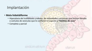 Implantación
• Mola hidatidiforme
• Hiperplasia del trofoblasto y edema de vellosidades coriónicas que forman bandas
o cúmulos de vesículas que le confieren el aspecto a “racimos de uvas”
• Completa y parcial
 
