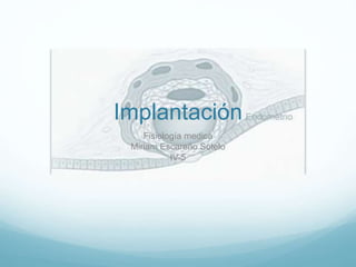 Implantación
Fisiología medica
Miriam Escareño Sotelo
IV-5
 